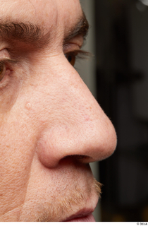 HD Face Skin Steve Q face nose scar skin pores…